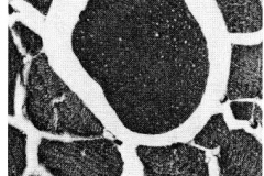giant_fiber