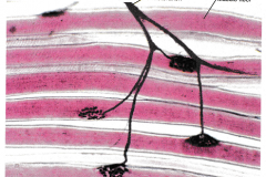 nervemuscle1