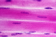 normal_muscle_fibers