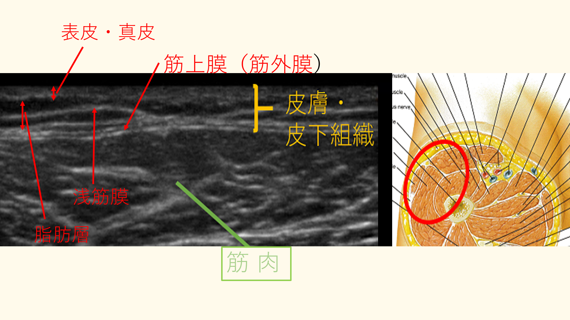 鍼は痛いのか？ | Art dry-needling＆massage